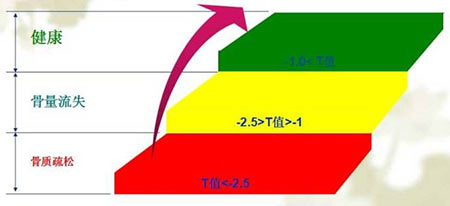 骨密度檢測儀